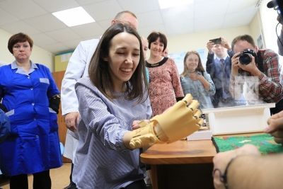 Лишившейся руки студентке из Набережных Челнов устанавливают напечатанный на 3D-принтере протез